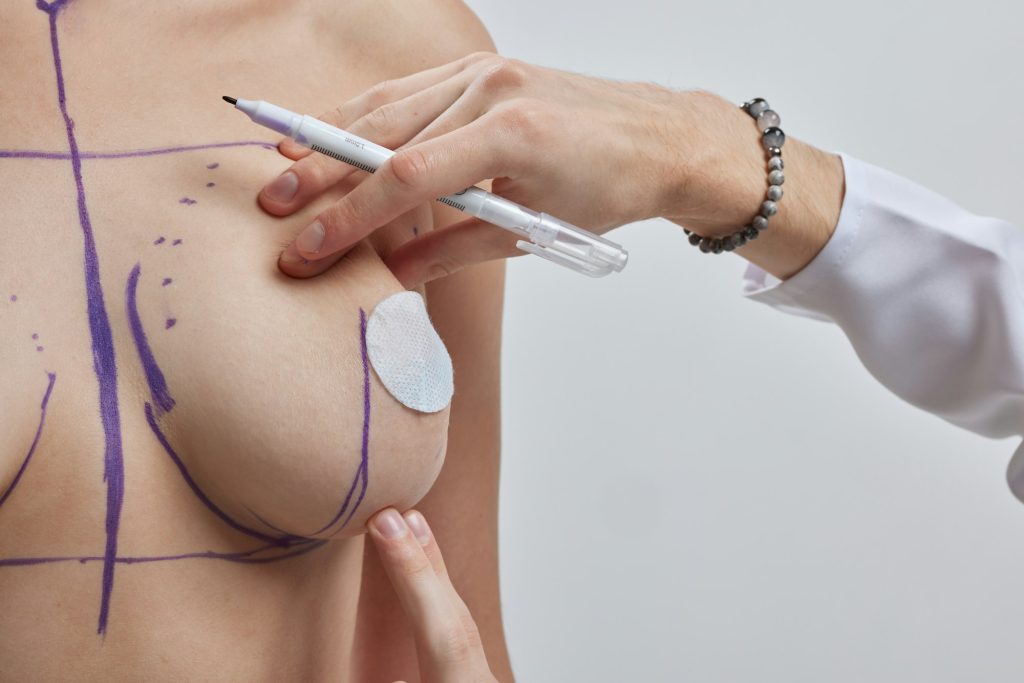 Doctor hand drawing lines on woman breast, breast implant surgery concept.