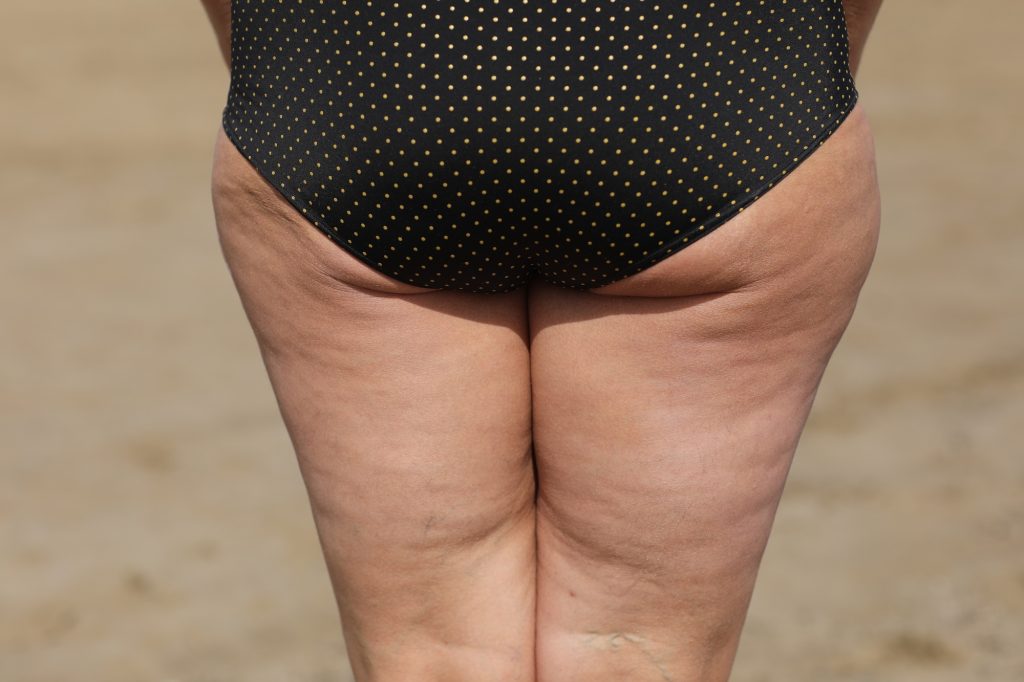 Fat female body with cellulite, fatty hips and buttocks, isolated on white background.
